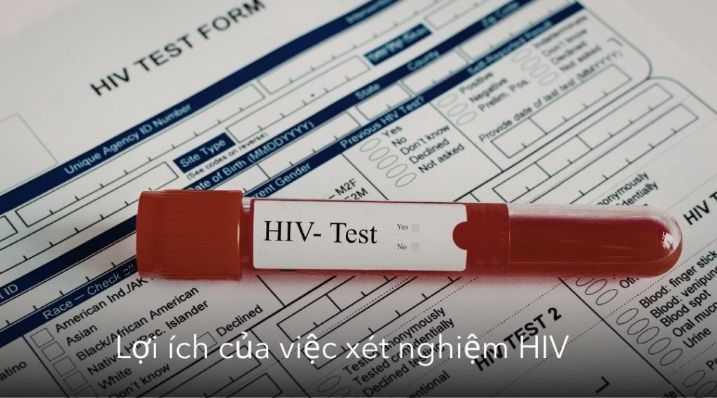 Lợi ích của việc xét nghiệm HIV