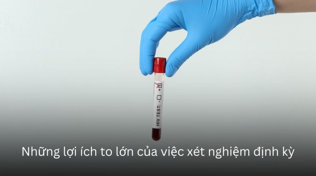 Những lợi ích to lớn của việc xét nghiệm định kỳ