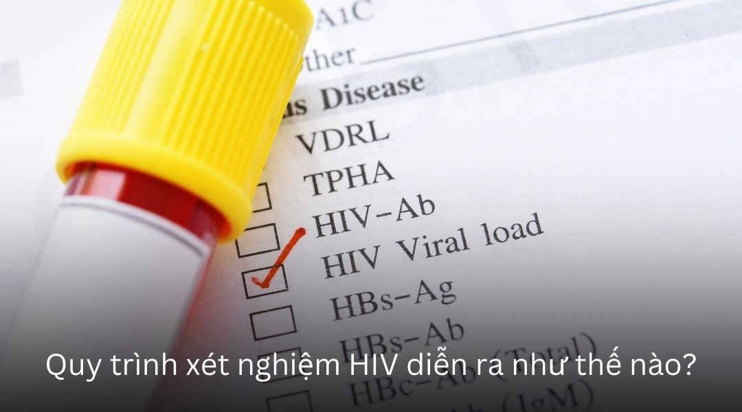 Quy trình xét nghiệm HIV