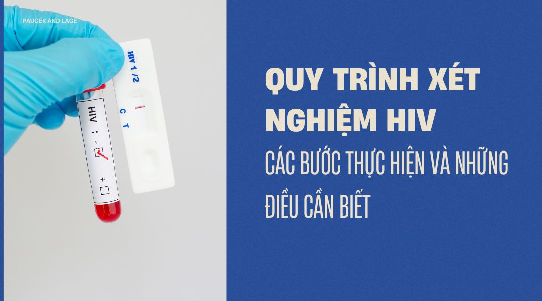 Quy trình xét nghiệm HIV