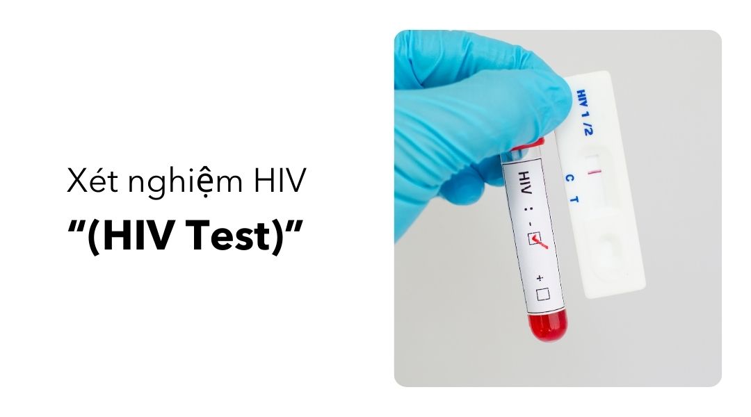 Xét nghiệm HIV (HIV Test)