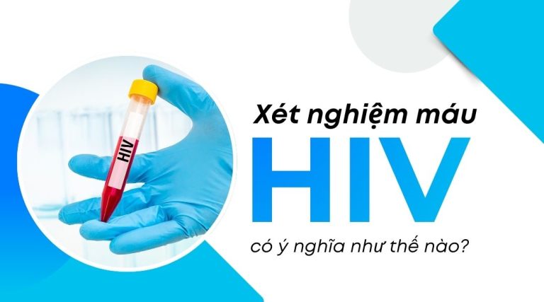 Xét nghiệm máu HIV có ý nghĩa như thế nào