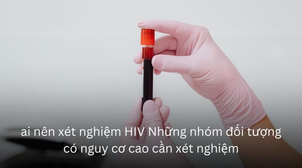Ai nên xét nghiệm HIV? 