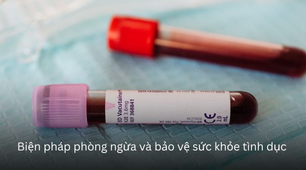 Quan hệ bằng miệng 