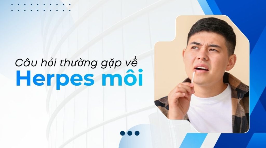 Câu hỏi thường gặp về herpes môi
