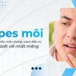 Herpes môi (mụn rộp môi) là gì Nguyên nhân, triệu chứng, cách điều trị và sự khác biệt với nhiệt miệng