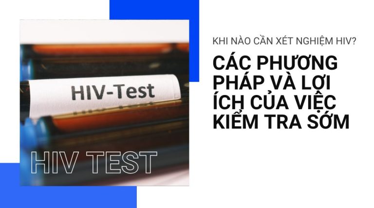 Khi nào cần xét nghiệm HIV? Các phương pháp và lợi ích của việc kiểm tra sớm