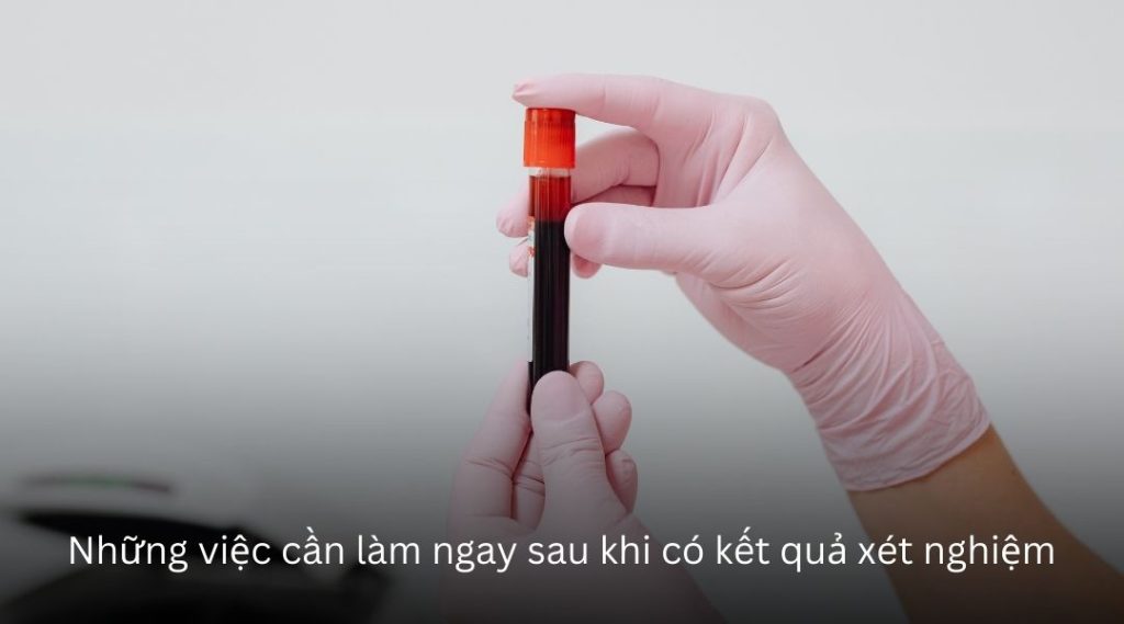 Những việc cần làm ngay sau khi có kết quả xét nghiệm