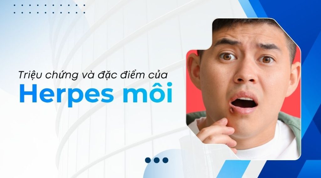 Triệu chứng và đặc điểm của herpes môi