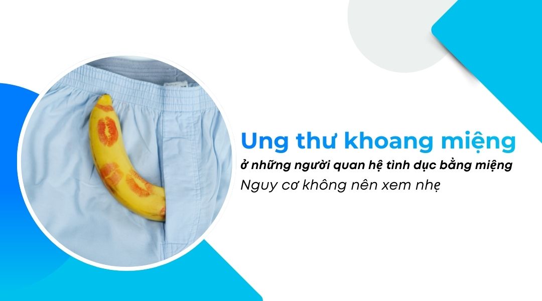Ung thư khoang miệng ở những người quan hệ tình dục bằng miệng – Nguy cơ không nên xem nhẹ