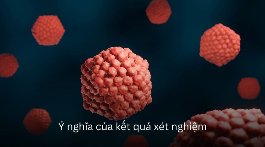 Ý nghĩa của kết quả xét nghiệm